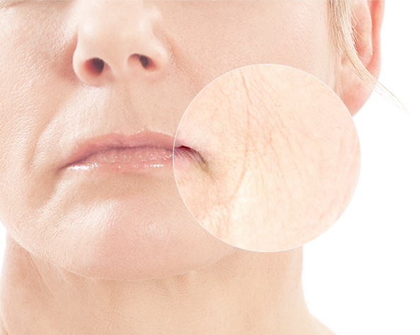 Experience the rejuvenating power of Rejuran Healer, enhancing skin elasticity and hydration while fighting fine lines.