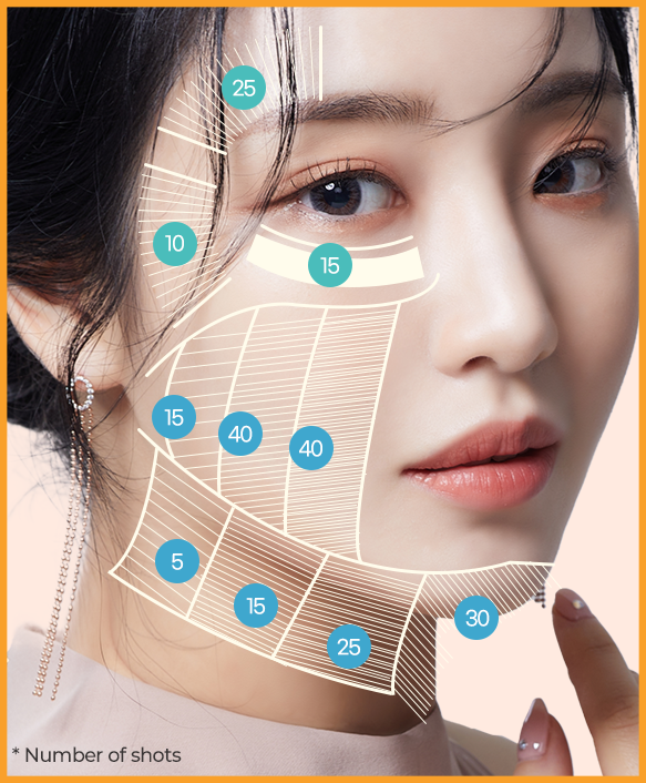 Before and after Ultherapy Lifting showing improved facial contours and skin firmness.