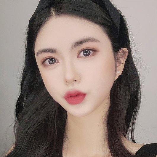 Before and after double eyelid surgery at Lienjang, achieving beautifully defined eyelids for a brighter, more youthful look.