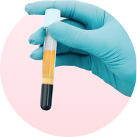 Lienjang's stem-cell IV drip treatment combines autologous stem cells and immune-boosting therapies for a safe, rejuvenating anti-aging experience.