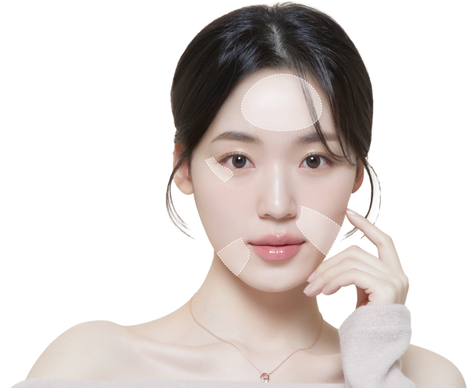 Ultrasound-guided thread lifting at Lienjang: A modern technique for a lifted, smooth look with minimal discomfort and rapid recovery