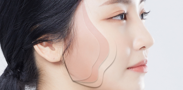Consult with Lienjang Plastic Surgery Center for customized SMAS facelift procedures that enhance natural beauty and restore youthful contours