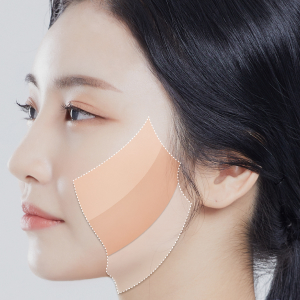 Mini SMAS facelift transformation at Lienjang, delivering smoother skin and lifted facial features with minimal downtime