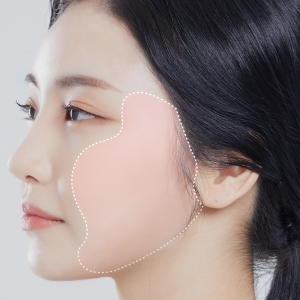 Minimally invasive SMAS facelift at Lienjang Plastic Surgery Center for a lifted, youthful facial appearance