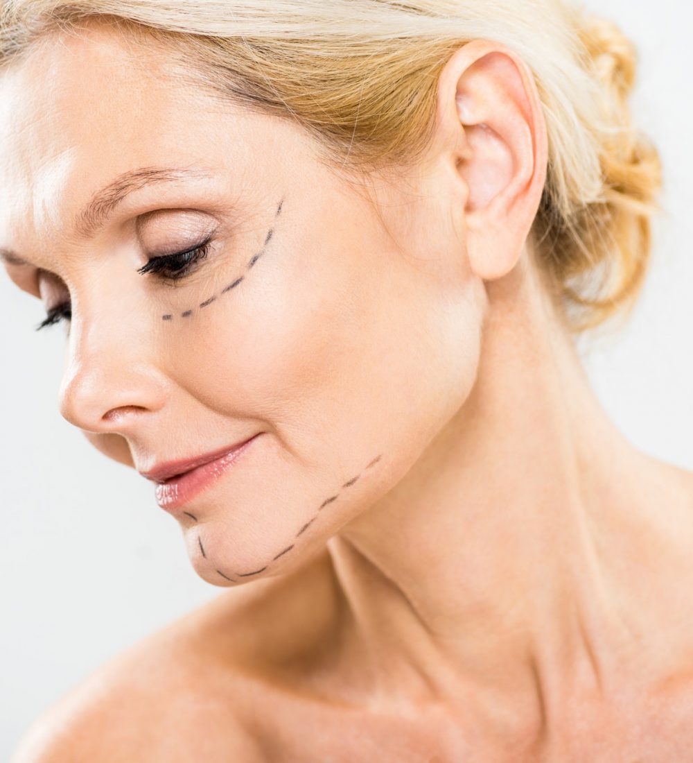 Facial lifting surgery at Lienjang Plastic Surgery Center, tightening skin and reducing sagging for a more youthful and rejuvenated look.