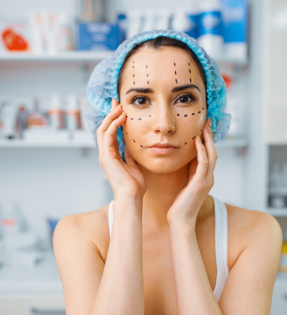 Patient with markers on face, preparation to botox
